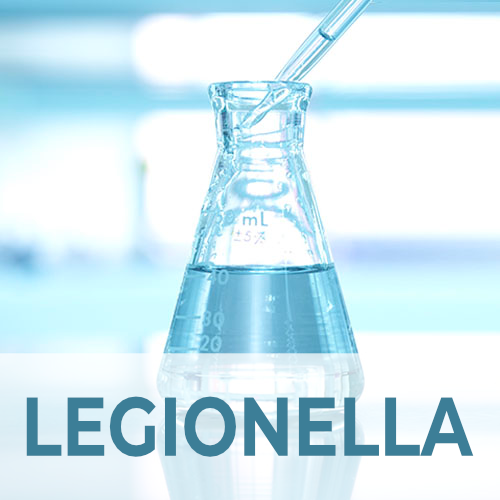 3/5 Analisi presenza di  Legionella pneumophila 